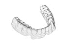 Orthodontics & Direct Aligners (Memory Shape)